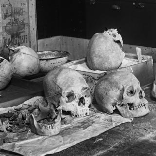 Human skulls on table in 1920s. (Source: Library of Congress)