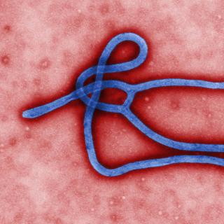 Digitally-colorized, transmission electron microscopic image which demonstrates the filamentous, branching structure of an Ebola virus particle. (Source: CDC)