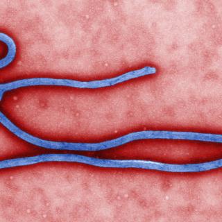 Digitally-colorized, transmission electron microscopic image which demonstrates the filamentous, branching structure of an Ebola virus particle. (Source: CDC)