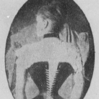 Woman with tight corset seen from the back.