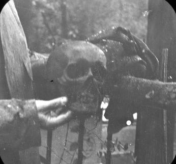 The hands of William Bishop holding the skull of James Smithson