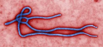 Digitally-colorized, transmission electron microscopic image which demonstrates the filamentous, branching structure of an Ebola virus particle. (Source: CDC)
