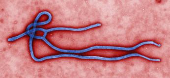 Digitally-colorized, transmission electron microscopic image which demonstrates the filamentous, branching structure of an Ebola virus particle. (Source: CDC) Digitally-colorized, transmission electron microscopic image which demonstrates the filamentous, branching structure of an Ebola virus particle. (Source: CDC)