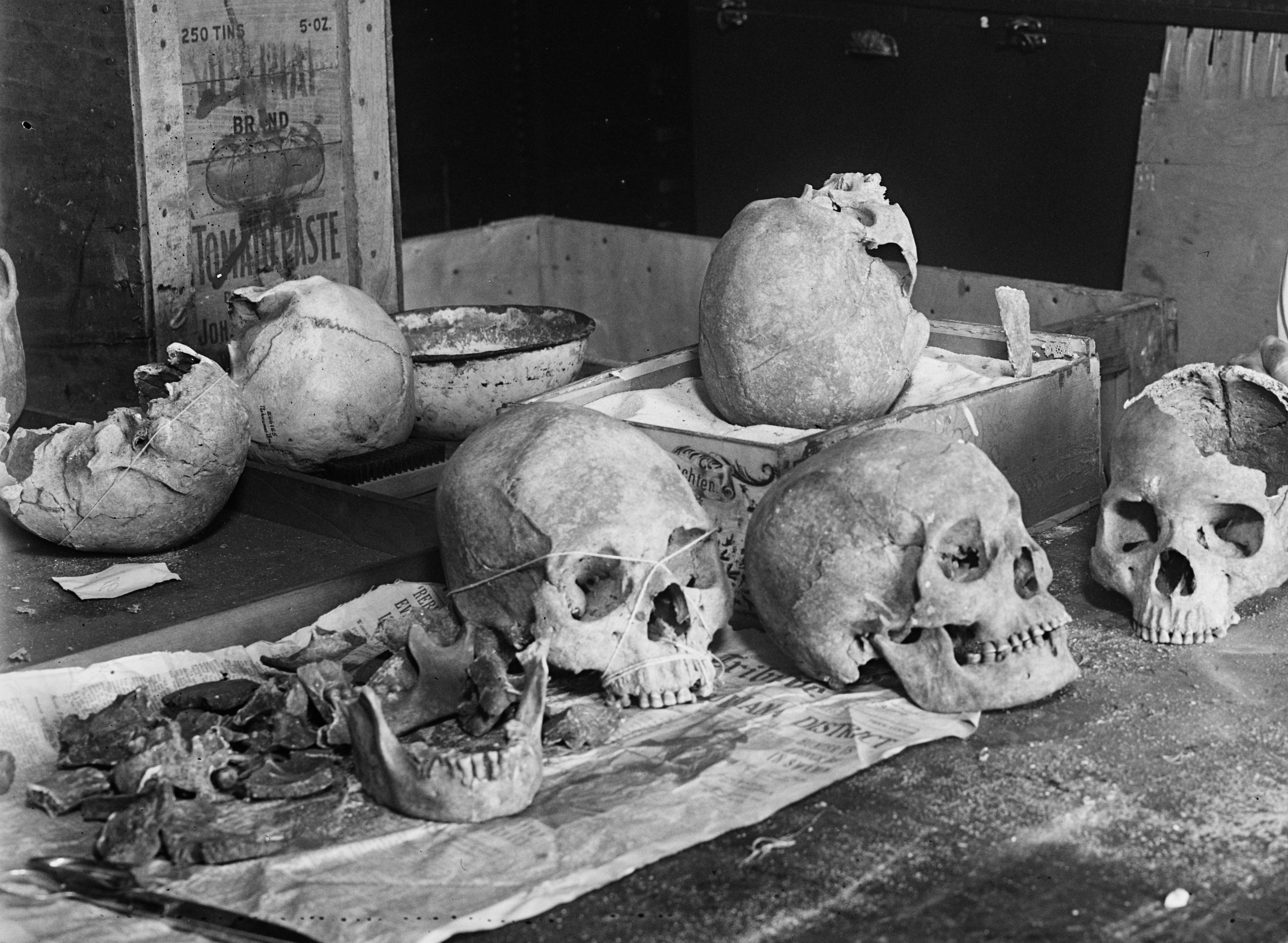 Human skulls on table in 1920s. (Source: Library of Congress)